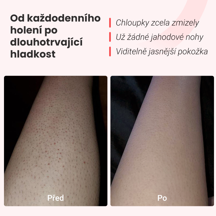 Hilda IPL epilátor