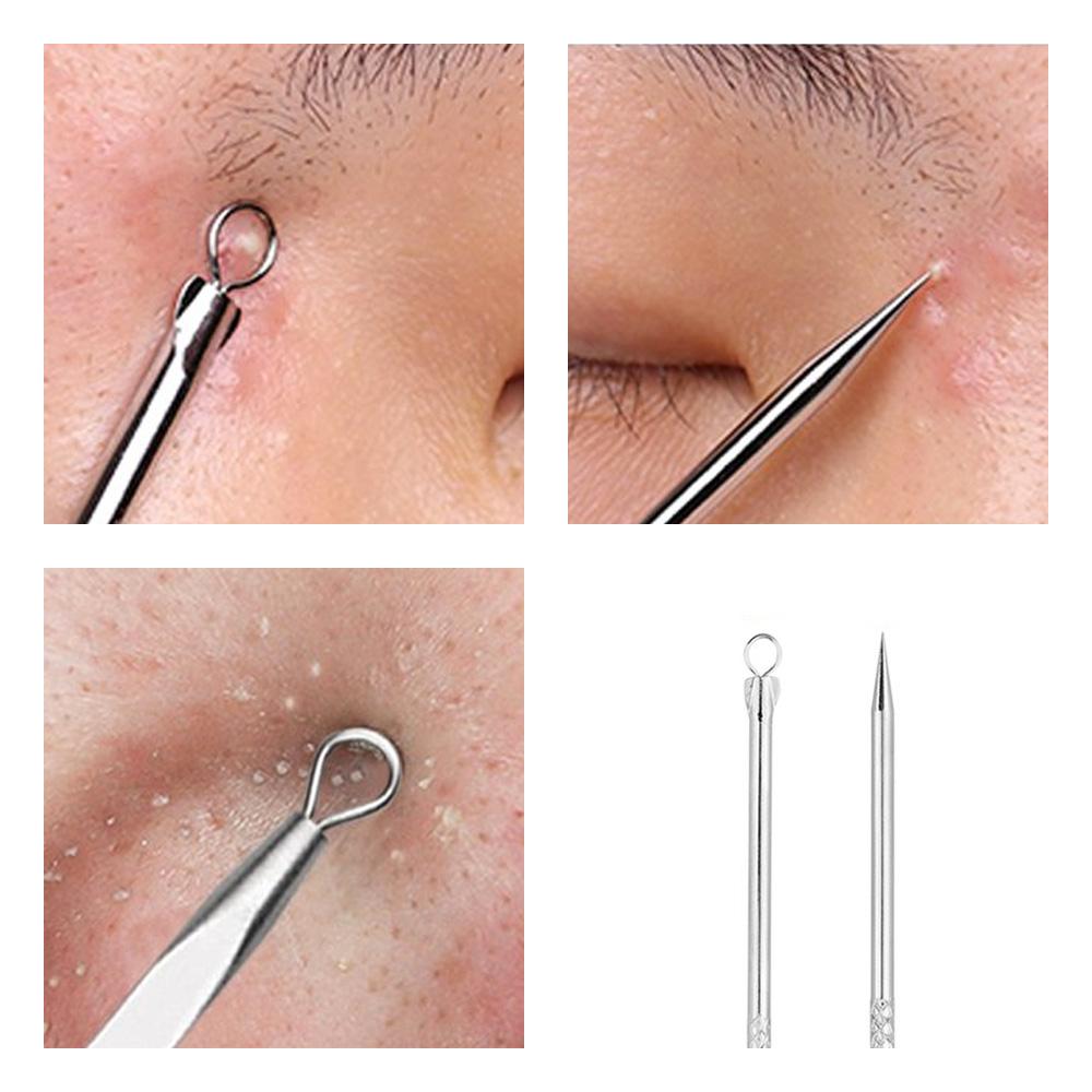 Spuogų ir inkštirų šalinimo įrankis su standartine ovalia kilpa ir smailiu galu - Odos centras, alternatyva kosmetologui, alternatyva dermatologui, alternatyva grozio salonui, alternatyva spa centrui, giluminis odos valymas, odos prieziura, inkstiru valymas, aparatas, prietaisas